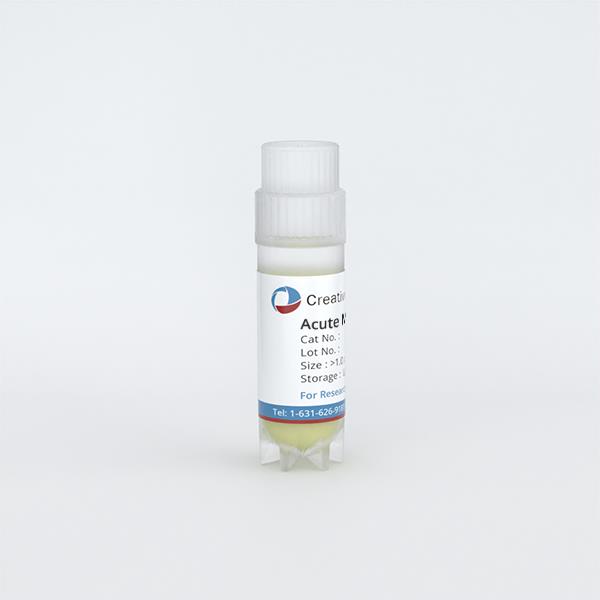 Acute Myeloid Leukemia Bone Marrow CD34+ Cells